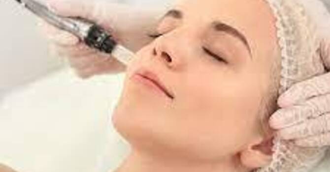 Maintenance Membership